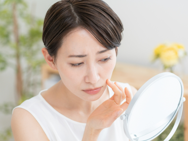 ニキビ跡の赤み